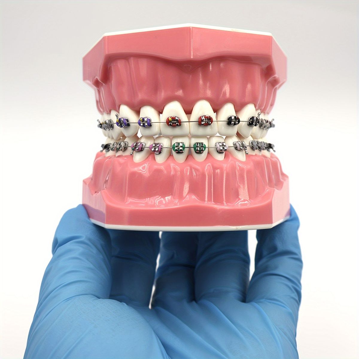 Niềng Răng Trả Góp 0% Tại Hải Phòng